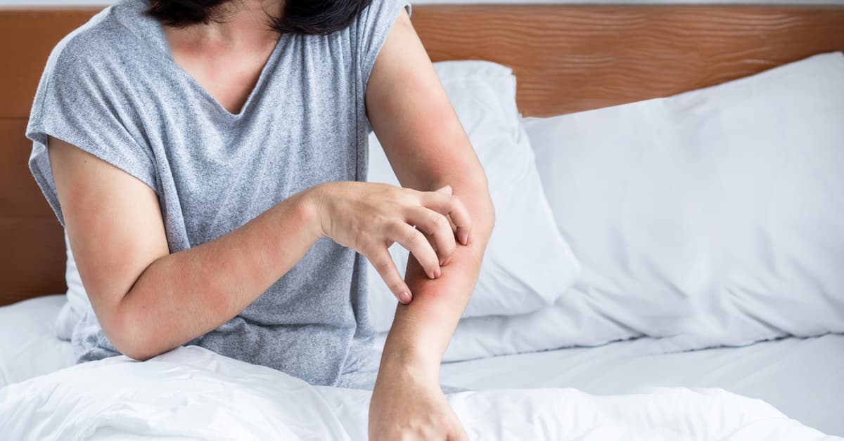 How holiday travel increases bed bug risk in Boise